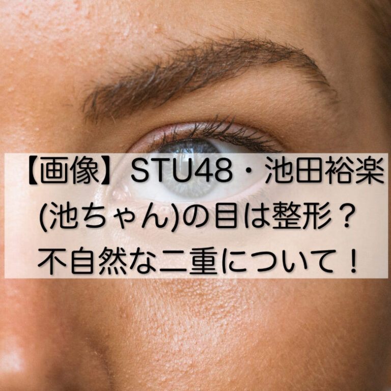 【画像】STU48・池田裕楽(池ちゃん)の目は整形？不自然な二重について！